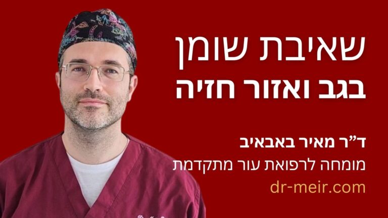 שאיבת שומן בגב - מטופלים לפני ואחרי - דר מאיר באבאיב - מומחה