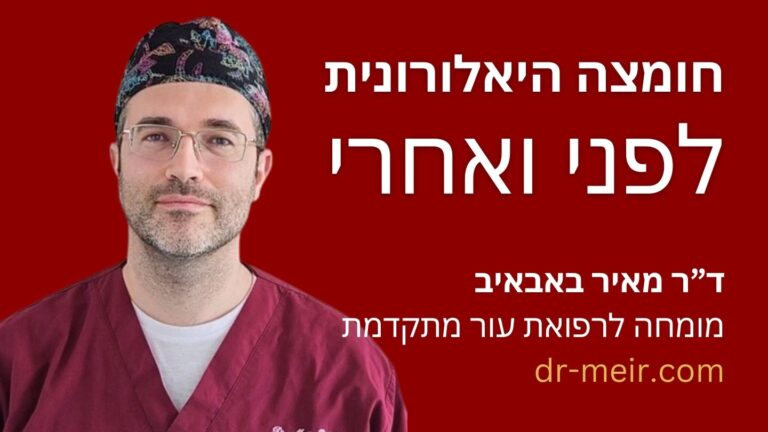חומצה היאלורונית לפני ואחרי - דר מאיר באבאיב מומחה לרפואת העור מתקדמת רופא עור