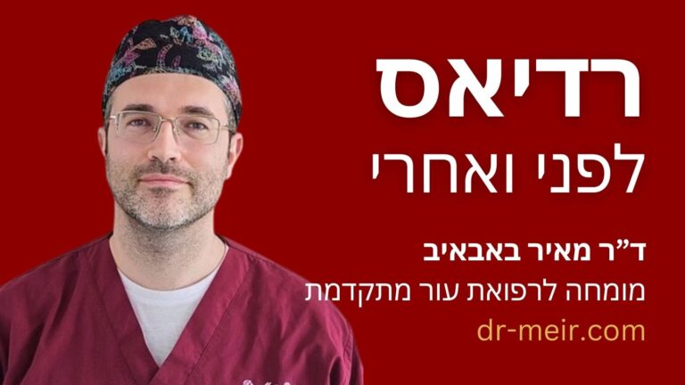 רדיאס לפני ואחרי - דר מאיר באבאיב מומחה לרפואת העור מתקדמת רופא עור (19)