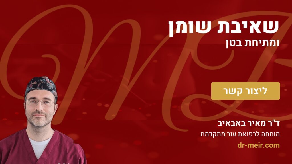 שאיבת שומן ומתיחת בטן - דר מאיר באבאיב