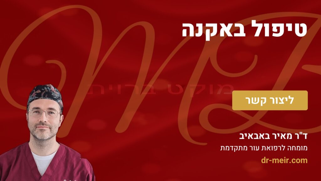 טיפול באקנה - דר מאיר באבאיב