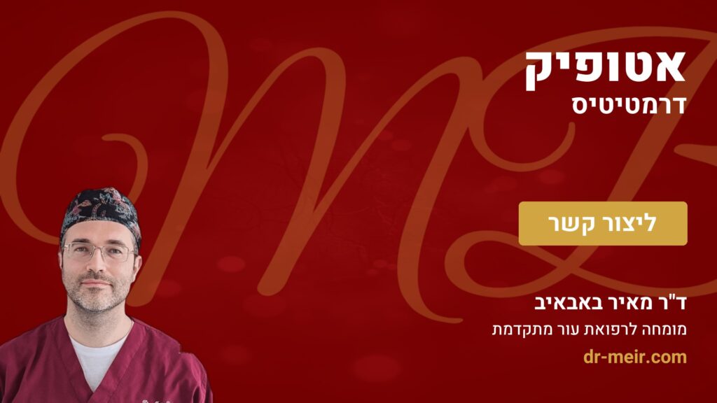 אטופיק דרמטיטיס - דר מאיר באבאיב