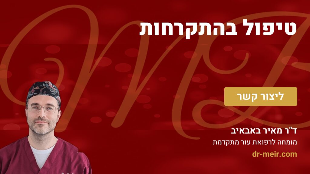 טיפול בהתקרחות - דר מאיר באבאיב