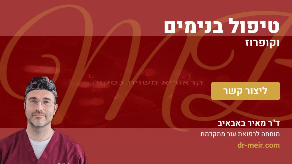 טיפול בנימים וקופרוז - דר מאיר באבאיב