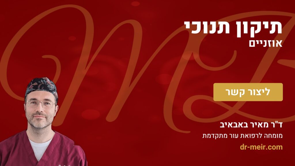 תיקון תנוכי אוזניים - דר מאיר באבאיב