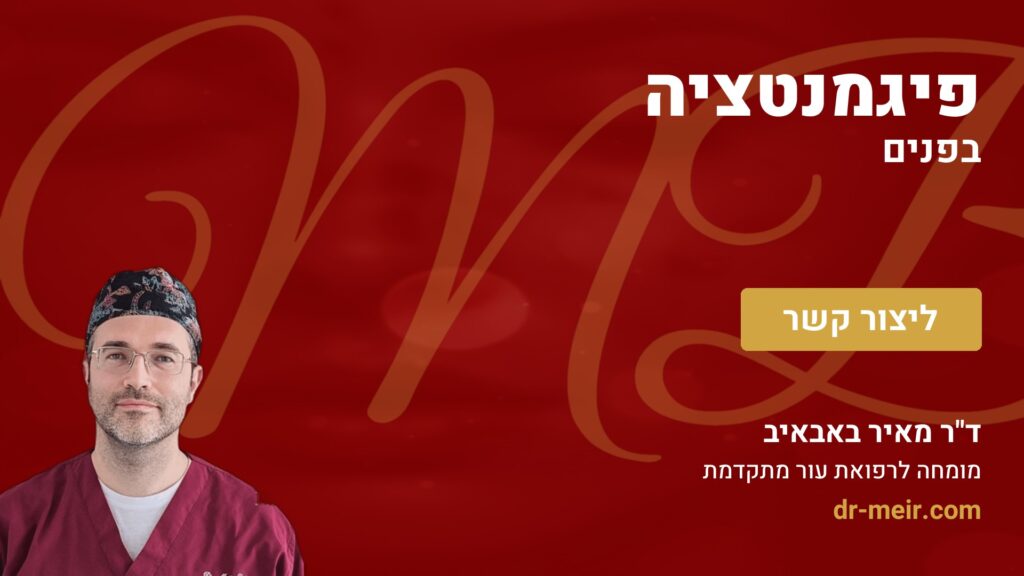 פיגמנטציה בפנים - דר מאיר באבאיב