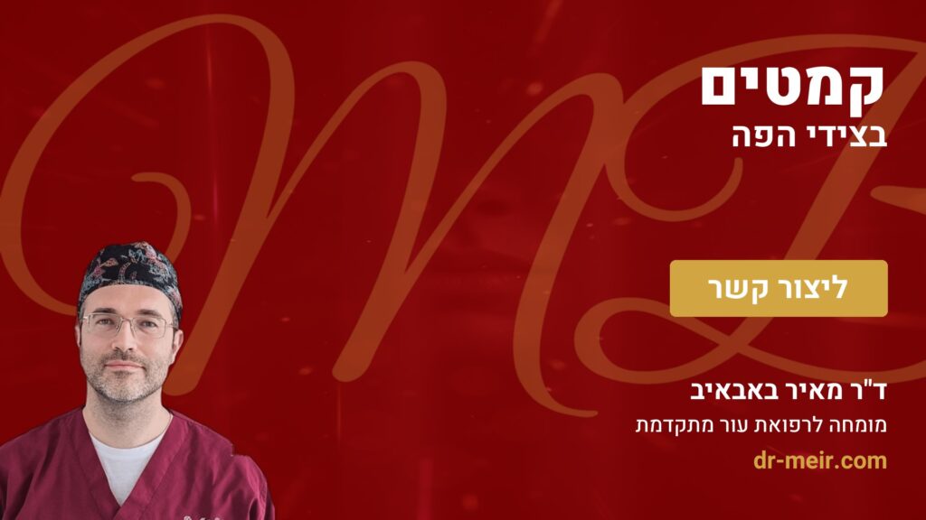קמטים בצידי הפה - דר מאיר באבאיב