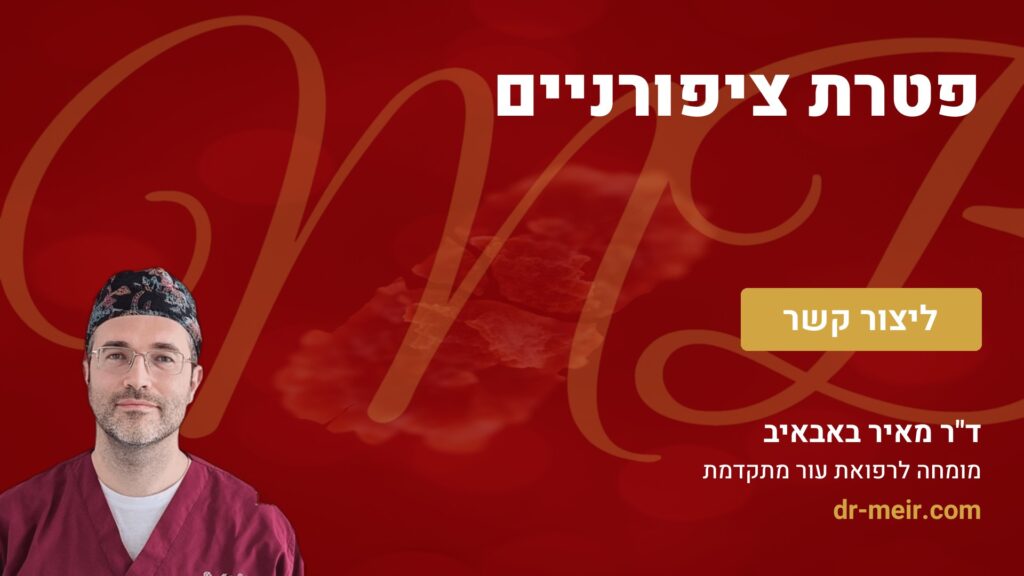 פטרת ציפורניים - דר מאיר באבאיב