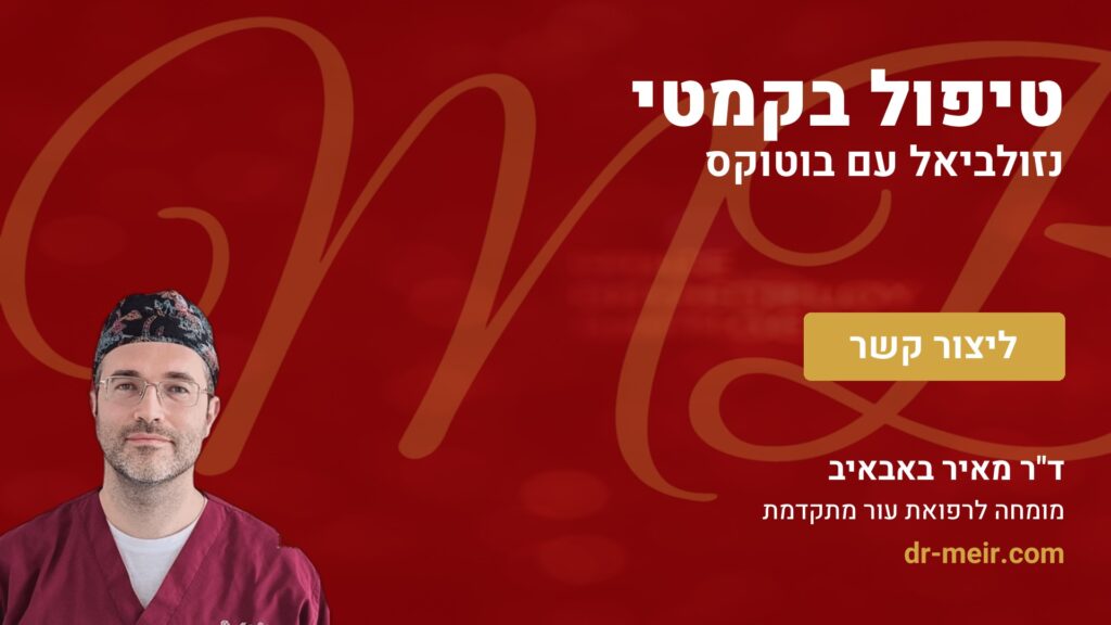 טיפול בקמטי נזולביאל עם בוטוקס - דר מאיר באבאיב