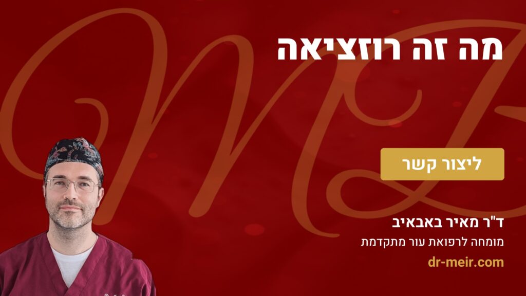 מה זה רוזציאה - דר מאיר באבאיב