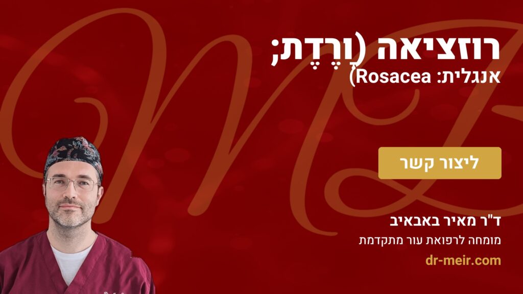 רוזציאה (וָרֶדֶת; אנגלית: Rosacea) - דר מאיר באבאיב