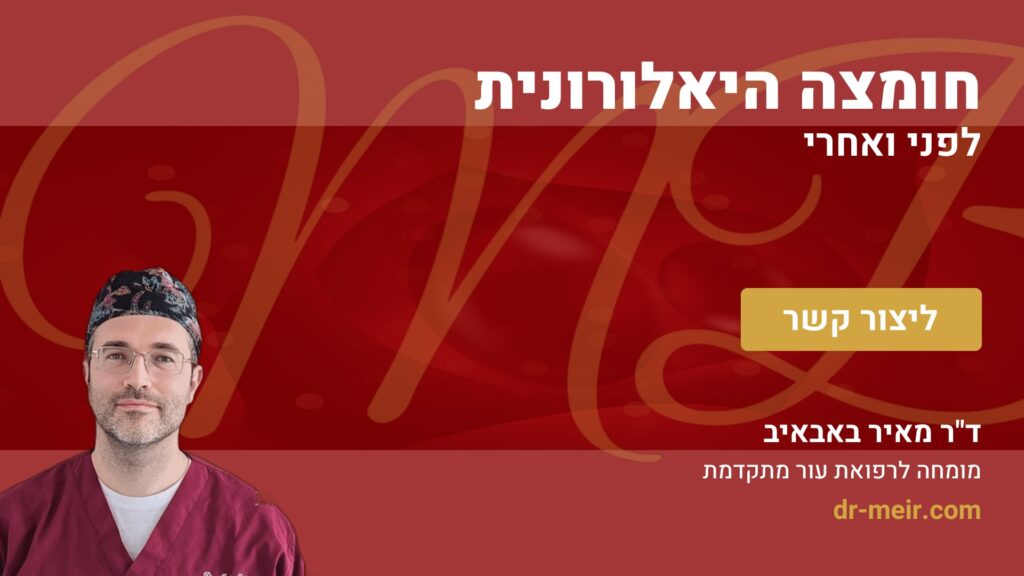 חומצה היאלורונית לפני ואחרי - דר מאיר באבאיב