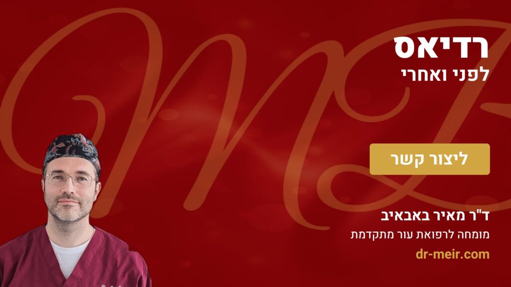רדיאס לפני ואחרי - דר מאיר באבאיב