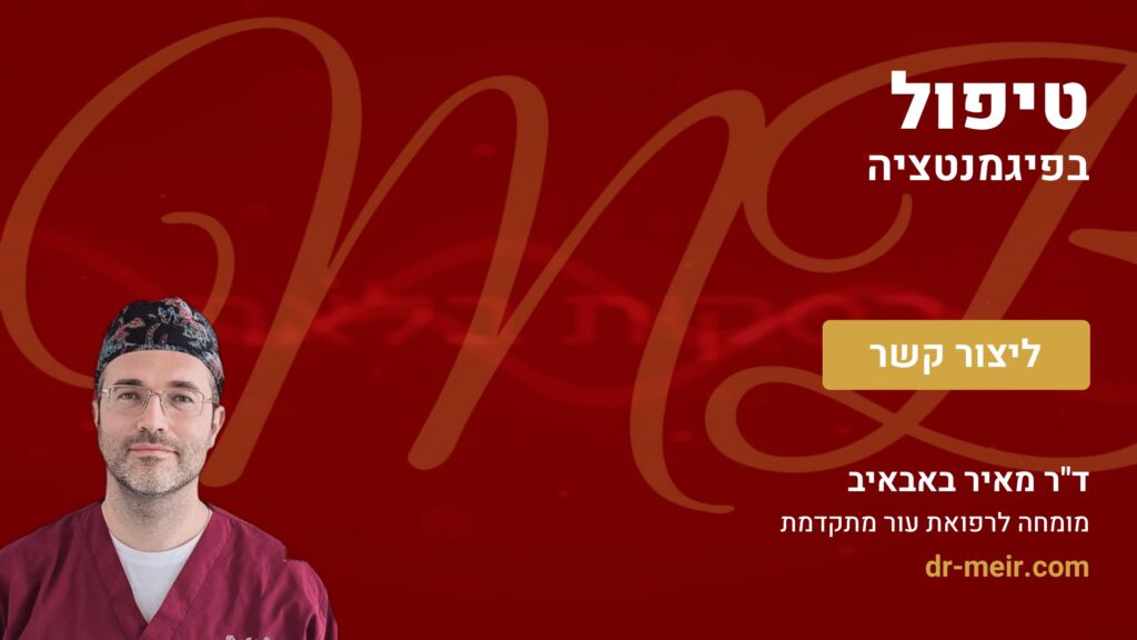 טיפול בפיגמנטציה - דר מאיר באבאיב
