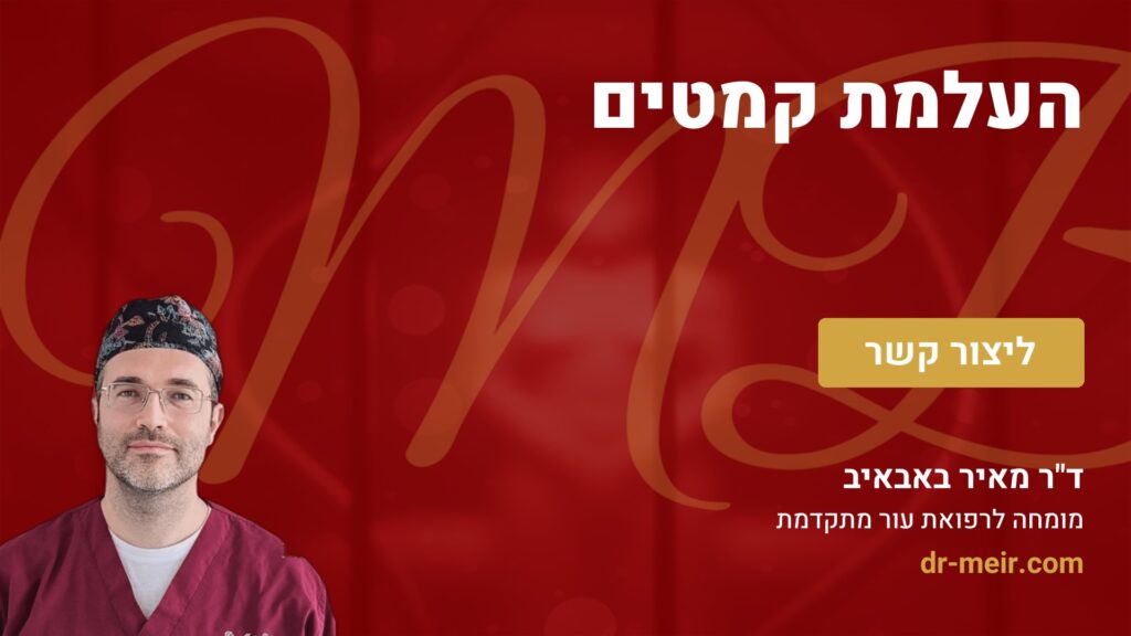 העלמת קמטים - דר מאיר באבאיב